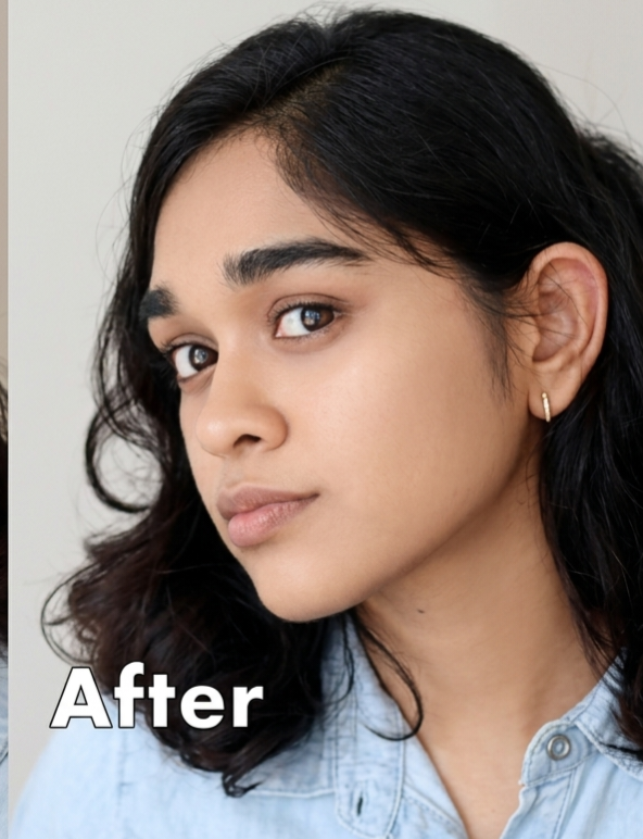 After Pore Treatment