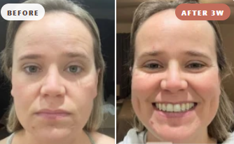 Karen Before and After