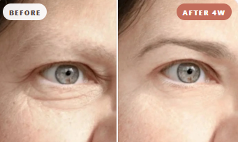 Nicole Before and After