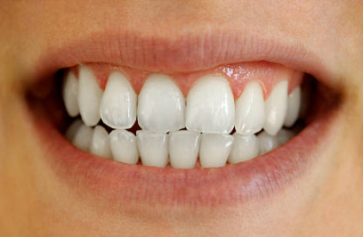 After Mouthwash Treatment